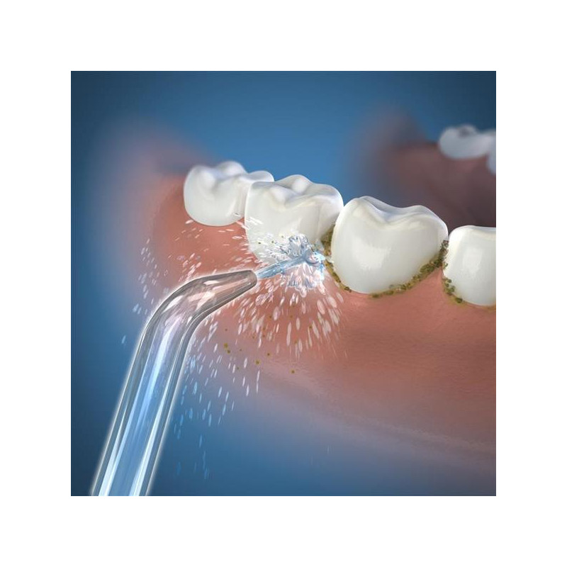 Waterpik - Pack de 3 Embout Hydropulseur Jet Classique JT-100