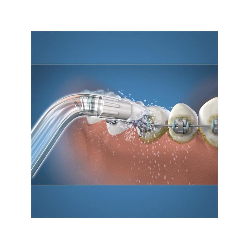 Waterpik - Pack de 3 Embout Hydropulseur Orthodontique OD-100E