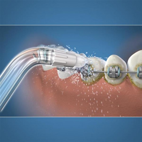 Waterpik - Pack de 3 Embout Hydropulseur Orthodontique OD-100E